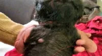 Baby Boy Born With Hair Over Half His Body- Its Causes And Risk
