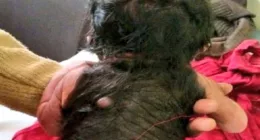 Baby Boy Born With Hair Over Half His Body- Its Causes And Risk