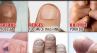 What Does Your Nail Say About Your Health? Warning Signs To Look Out For
