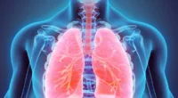 Lung Cancer: Its Warning Signs And Symptoms Revealed