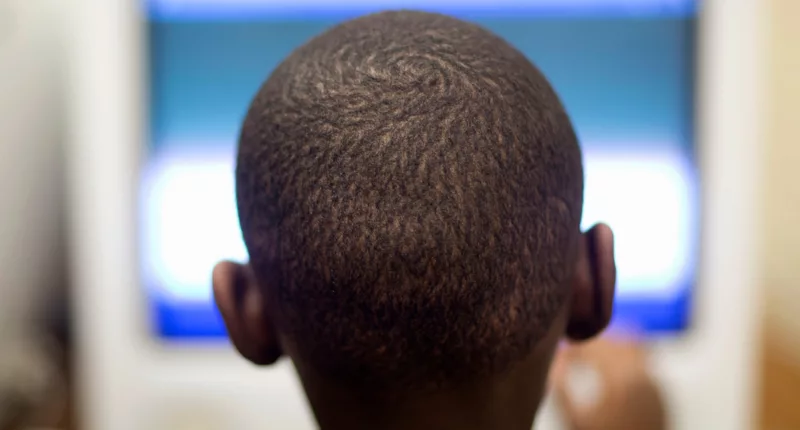 MRIs show stress from poverty, racism may alter brain development of Black kids, study from American Journal of Psychiatry says