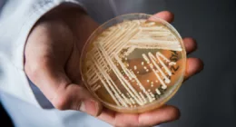 CDC warns of drug-resistant fungal infection