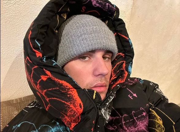 Justin Bieber facial paralysis And Diagnoses: What Is Ramsay Hunt Syndrome Diagnosis?
