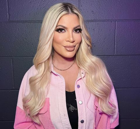 Tori Spelling Corneal Ulcer And Health Update: Corneal Ulcer Causes And Prevention
