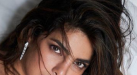 Priyanka Chopra Health Update: Priyanka Chopra Botched Nose Surgery Revealed