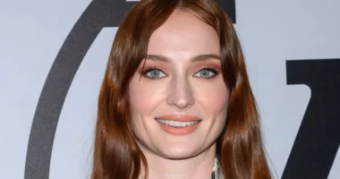Sophie Turner weight loss skinny face buccal fat removal