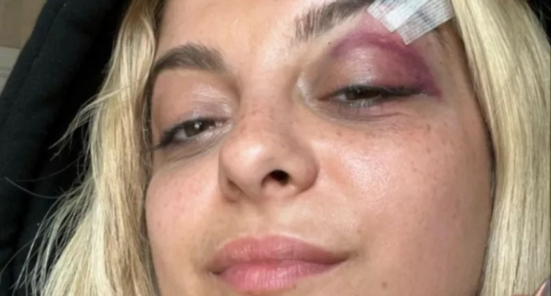 Bebe Rexha has reveals her injuries