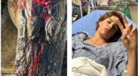 Gabriel Klimis (pictured right), 13, was playing with friends at Howell Creek near Orlando earlier this week when he was attacked by a gator