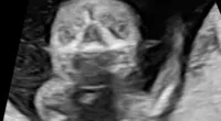 Whitney Cummings couldn't resist joking about the sonogram