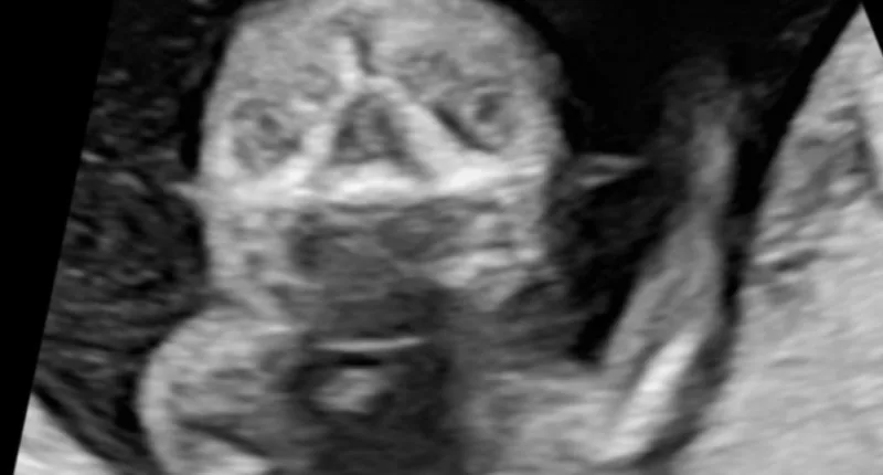 Whitney Cummings couldn't resist joking about the sonogram