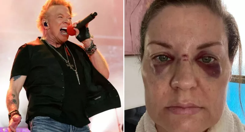 Axl Rose Accident
