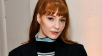 Nicola Roberts Plastic Surgery Before And After | What Is Wrong With Her Teeth