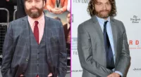 Zach Galifianakis Hair
