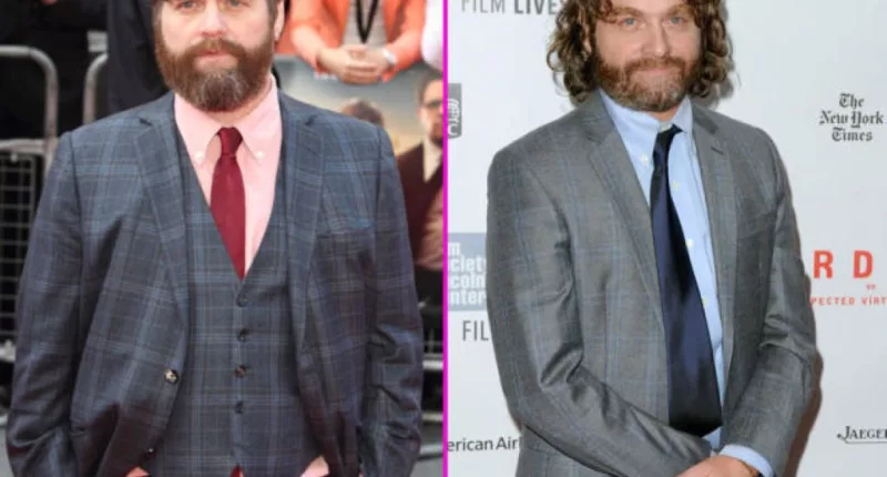Zach Galifianakis Hair