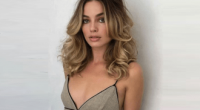 Margot Robbie Botox And Nose Job | Did She Get Surgery