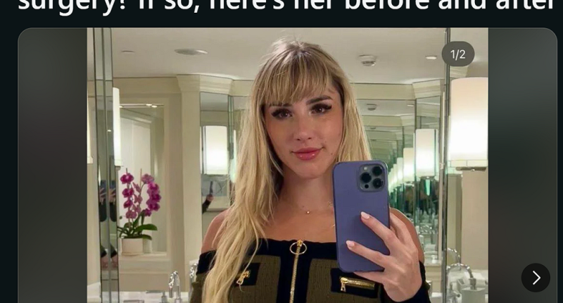 Mikhaila Peterson Nose Job