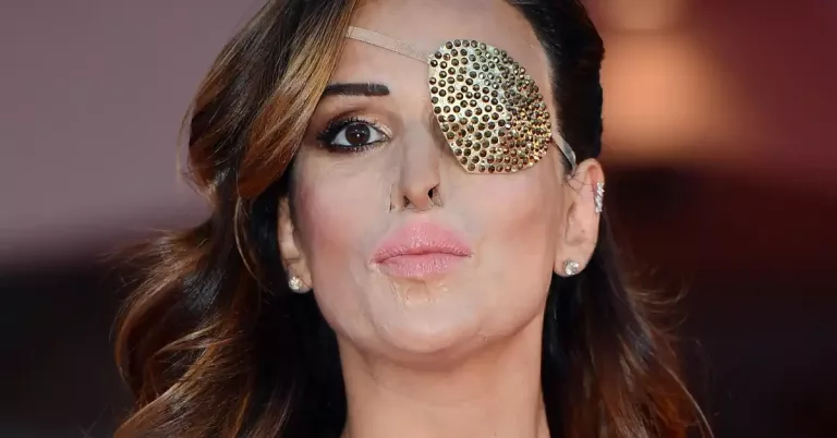 Gessica Notaro Prima Incidente Photo: What Happened To Filippo Bologni Moglie?