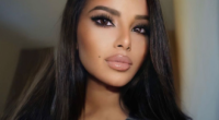 Ines Helene Before Plastic Surgery | Botox And Lip Filler