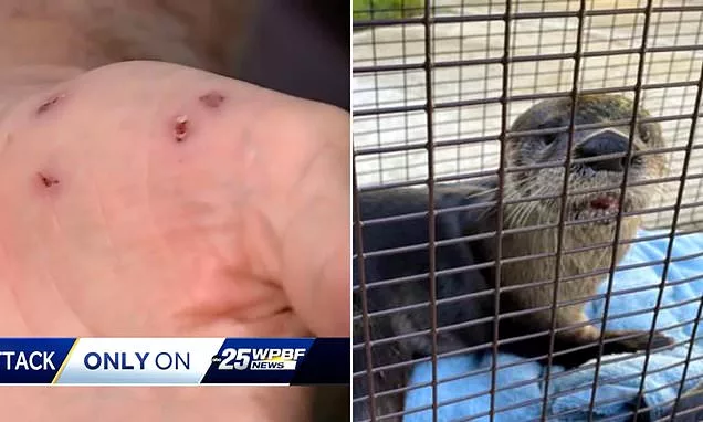 Rabid otter pounces on a Florida man biting his legs, hands and arms