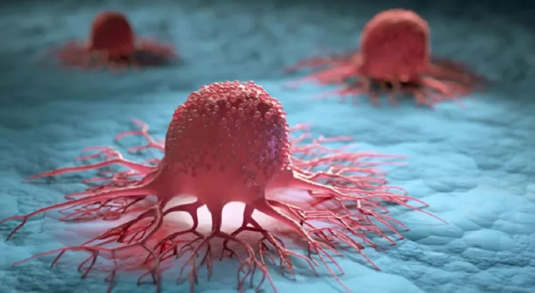 Saudia Nica Dimatulac Death And Obituary Linked To Cancer?