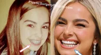 Addison Rae Teeth