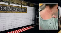 65-year-old woman attacked by madman blasts NYC leaders after suspect strikes again
