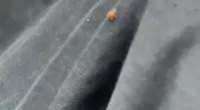 A horrified Londoner spotted a bedbug crawling up her leg