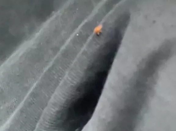 A horrified Londoner spotted a bedbug crawling up her leg