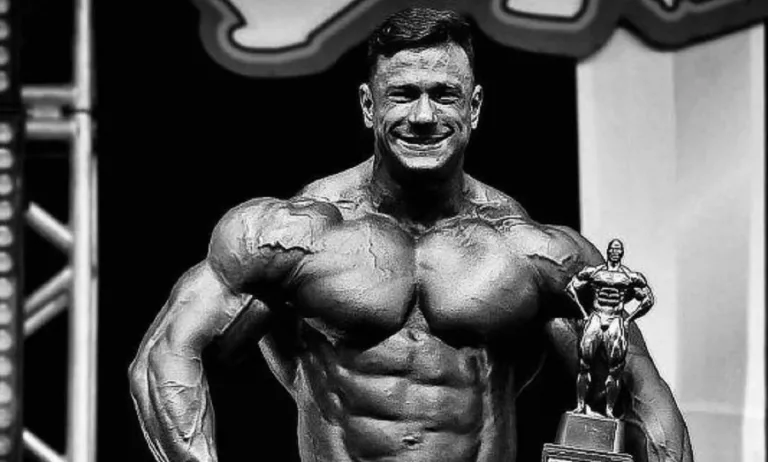 Bodybuilder Christian Figueiredo Death Due To Liver Surgery