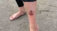 California surfer suffers bite to leg in reported shark attack