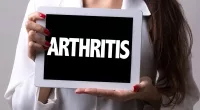Key Signs of Arthritis Striking in Your 30s | Stock Photo