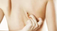 Home Remedies To Remove Skin Tags Naturally | Stock Photo