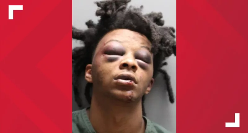 Mugshot shows Jacksonville man's swollen face after viral arrest