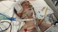 Groom-to-be Lee Burns was put into an induced coma after a stag do assault