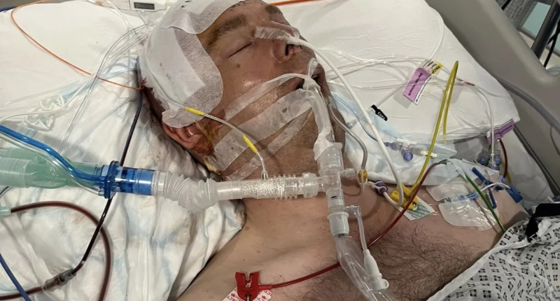 Groom-to-be Lee Burns was put into an induced coma after a stag do assault