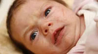 he majority of parents worry about a skin complaint in their baby's first year