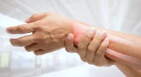 5 Effective Treatment Options for Arthritis-Induced Joint Pain | Stock Photo