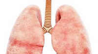 UK’s Deadliest Cancer: Lung Cancer, Its Symptoms And Causes