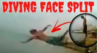 Face Split Diving Accident Video, What Happened In The Video?
