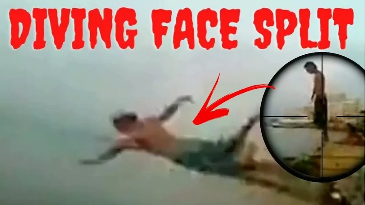 Face Split Diving Accident Video, What Happened In The Video?