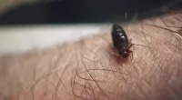 The pest swelled with blood after gorging on his arm
