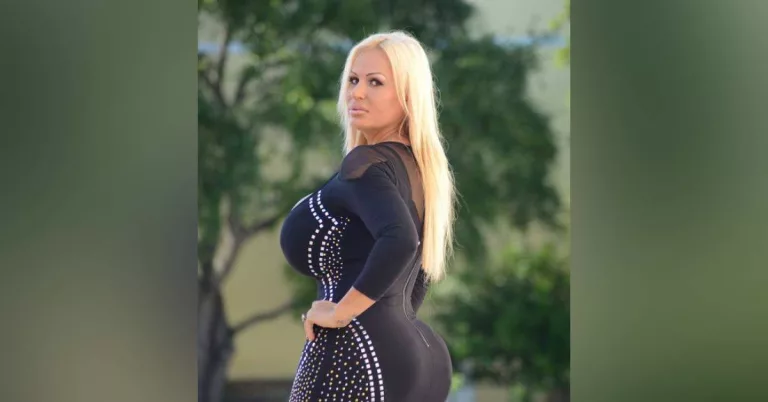 Botched: Lacey Wildd QQQ Plastic Surgery Before And After