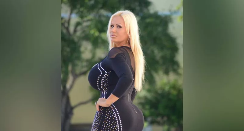 Lacey Wildd QQQ plastic surgery