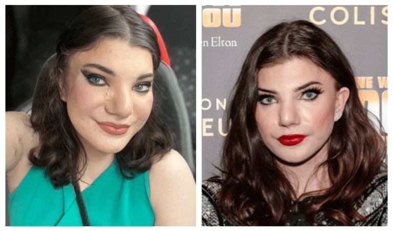 Does Elphaba Orion Doherty Have Any Disability: Was She Autistic?