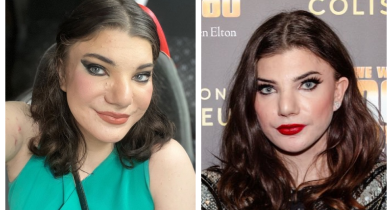 Does Elphaba Orion Doherty Have Any Disability: Was She Autistic?