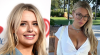 Has Corinna Kopf Get Plastic Surgery Done? Before and After Photos