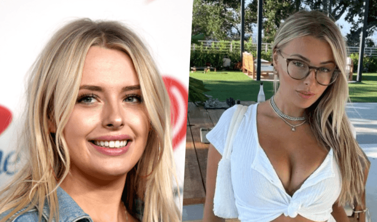 Has Corinna Kopf Get Plastic Surgery Done? Before and After Photos