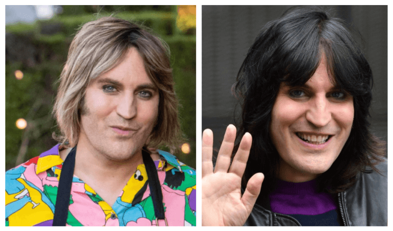 How Did Noel Fielding Gain Weight 2023? His Before And After Pictures