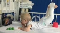 Little girl with hip dysplasia turns her story into a children's book