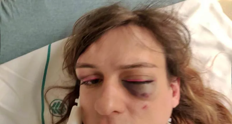 Moment North Carolina bouncer punches transgender woman in the face